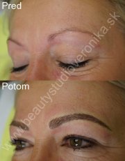 Permanentný make-up obočia čiarkovanou metódou