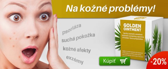 AVOS TRADE sro - recenzie, referencie, skúsenosti